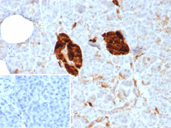 Enolase 2/Neuron-specific Enolase Antibody (ENO/8614R) - Azide and BSA Free