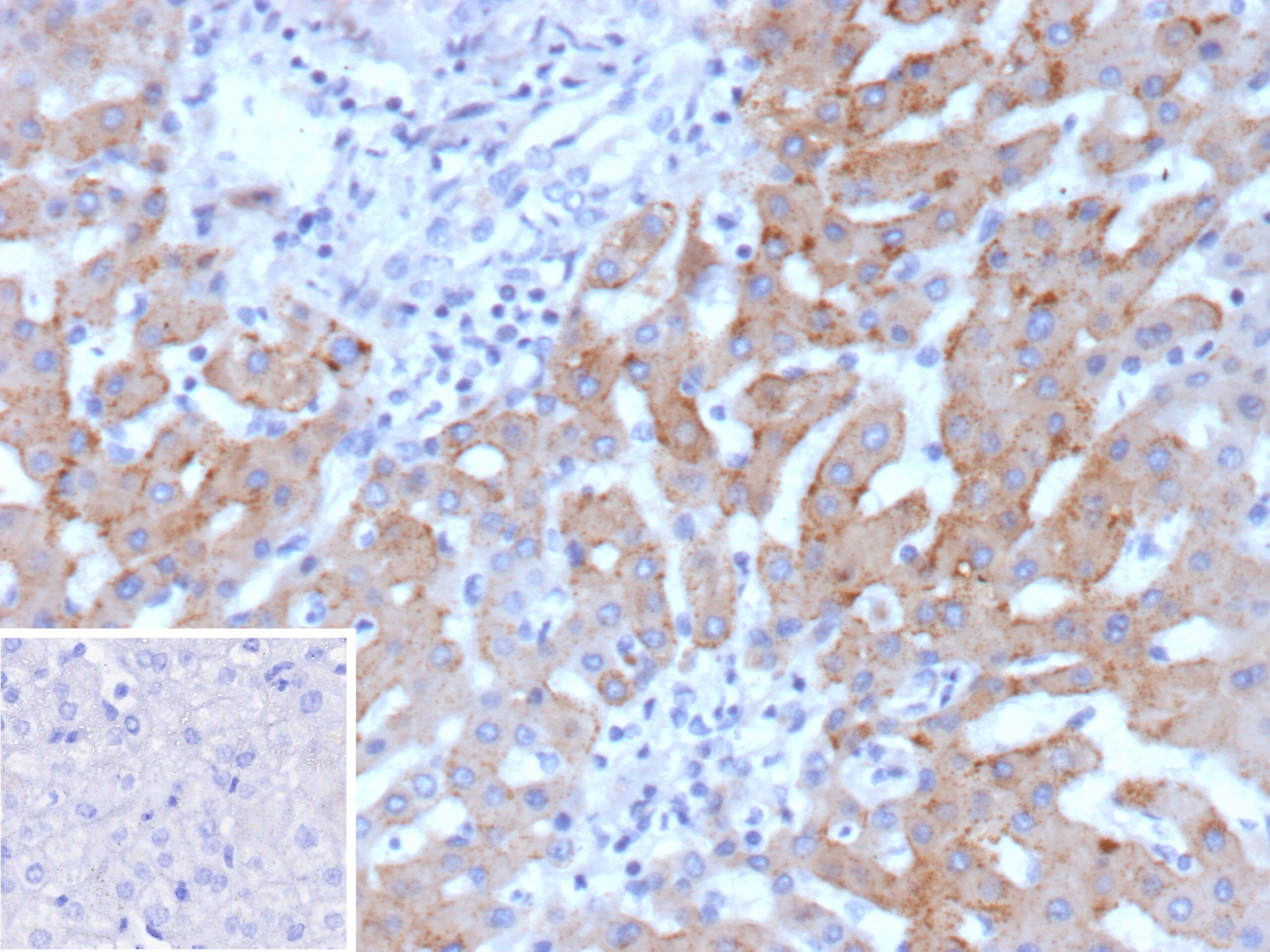 HSD17B13 Antibody (HSD17B13/13102) - Azide and BSA Free
