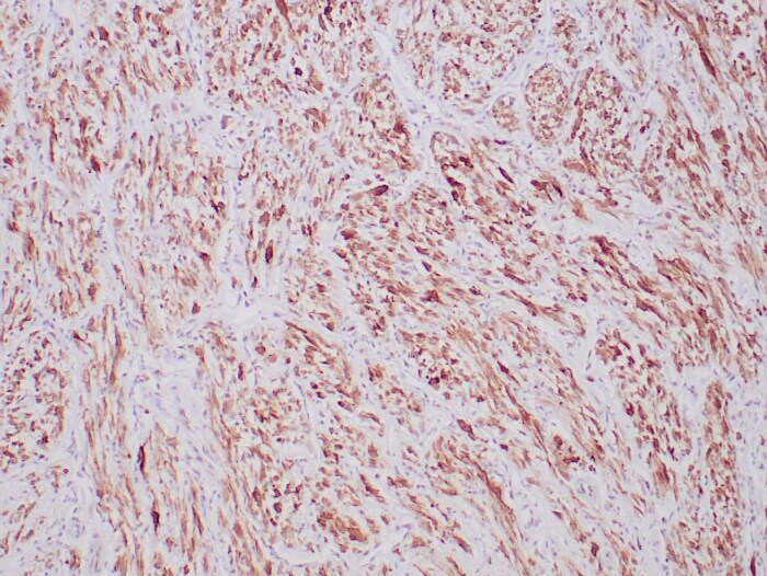 ALK/CD246 Antibody (ALK1/6698R) - Azide and BSA Free