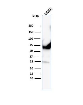 Albumin Antibody (ALB/6413R) - Azide and BSA Free
