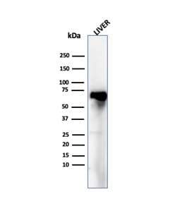 Albumin Antibody (ALB/6409R) - Azide and BSA Free