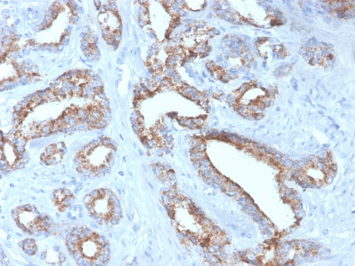 alpha-Methylacyl-CoA Racemase/AMACR Antibody (rAMACR/4674) - Azide and BSA Free
