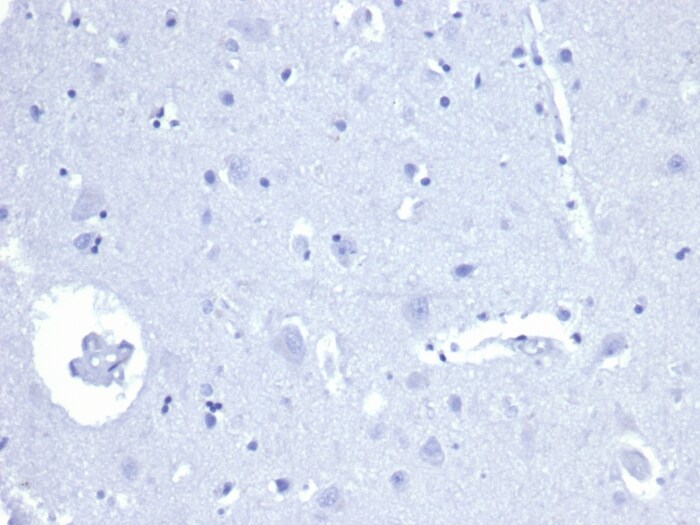 alpha-Methylacyl-CoA Racemase/AMACR Antibody (rAMACR/4674) - Azide and BSA Free