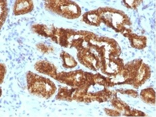 alpha-Methylacyl-CoA Racemase/AMACR Antibody (AMACR/3931R) - Azide and BSA Free