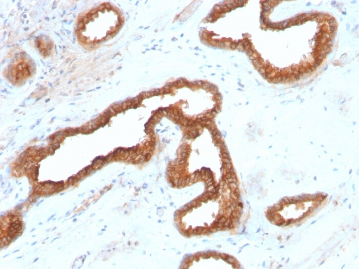 alpha-Methylacyl-CoA Racemase/AMACR Antibody (AMACR/2748R) - Azide and BSA Free