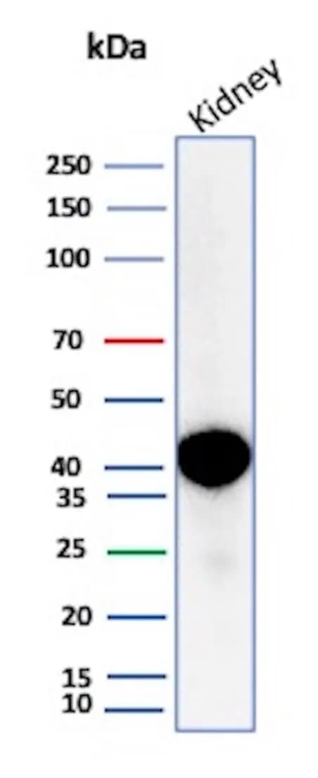 alpha-Methylacyl-CoA Racemase/AMACR Antibody (AMACR/2748R) - Azide and BSA Free