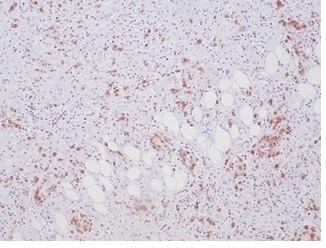 ALK/CD246 Antibody (ALK1/7008R) - Azide and BSA Free