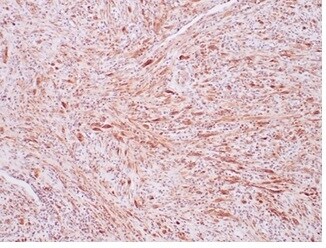 ALK/CD246 Antibody (ALK1/7008R) - Azide and BSA Free