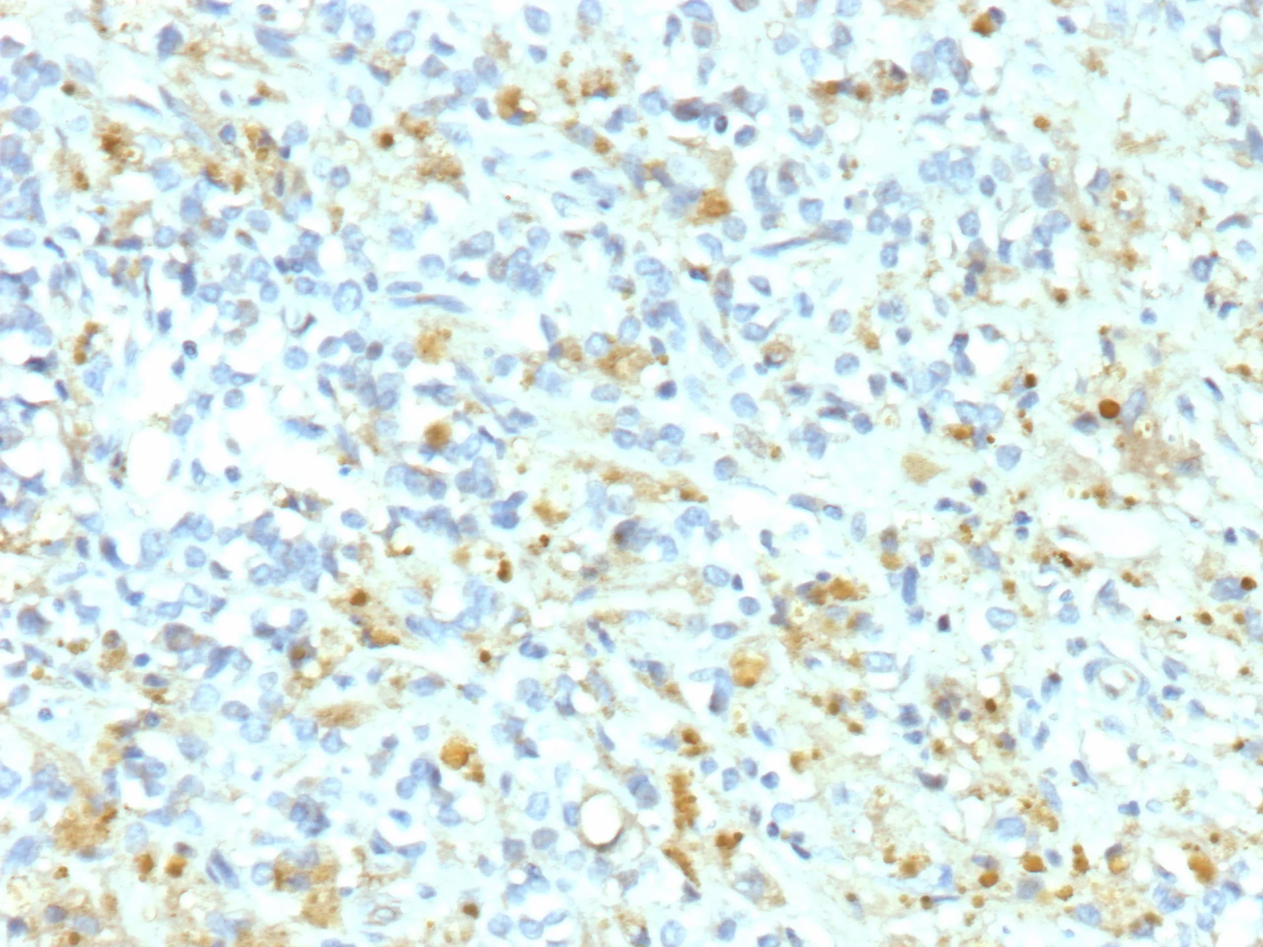 ALK/CD246 Antibody (ALK1/9660R) - Azide and BSA Free