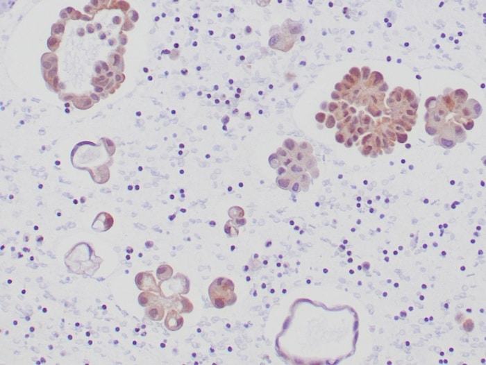 ALK/CD246 Antibody (ALK1/6698R) - Azide and BSA Free