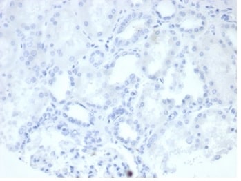 Alkaline Phosphatase/ALPP/ALPI Antibody (rALP/870) - Azide and BSA Free