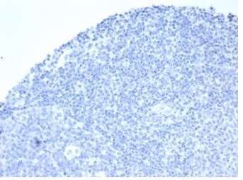 Alkaline Phosphatase/ALPP/ALPI Antibody (rALP/870) - Azide and BSA Free