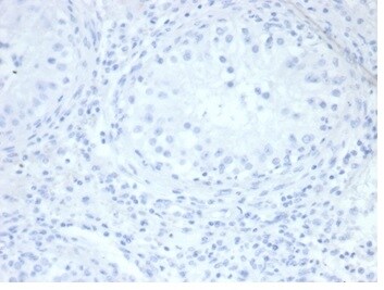 Alkaline Phosphatase/ALPP/ALPI Antibody (rALP/870) - Azide and BSA Free