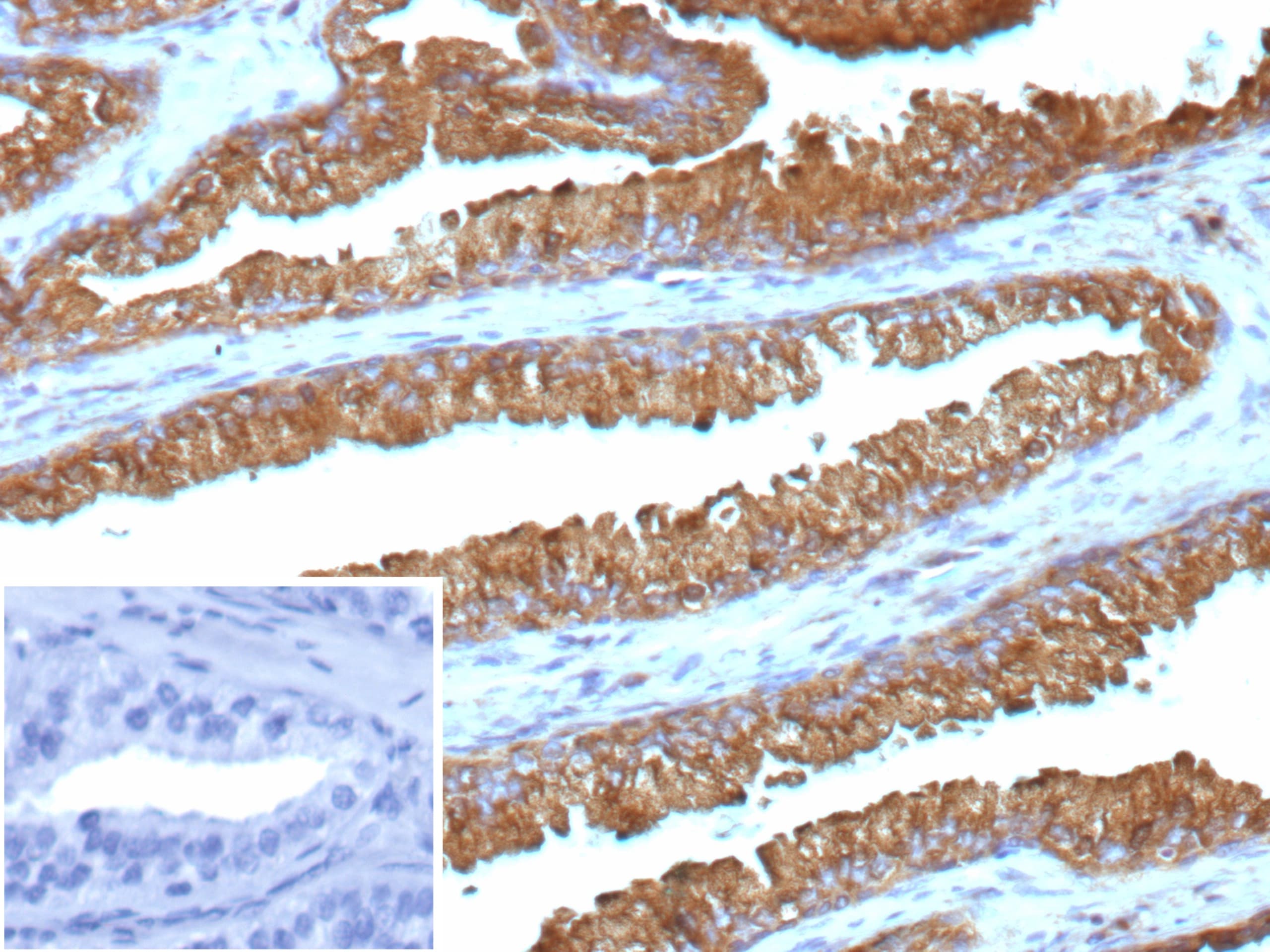 Isocitrate Dehydrogenase 1/IDH1 Antibody (IDH1.R132G/13054R) - Azide and BSA Free