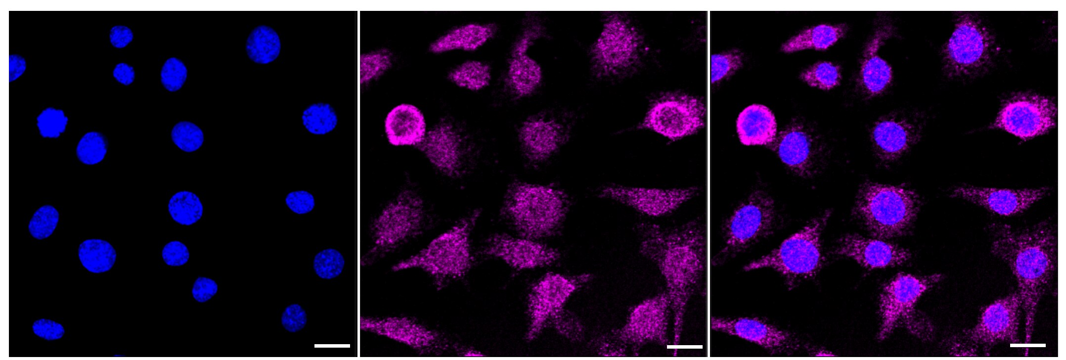 Activin RIIB Antibody (23GB620)