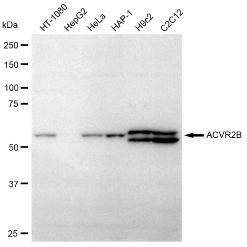 Activin RIIB Antibody (23GB620)