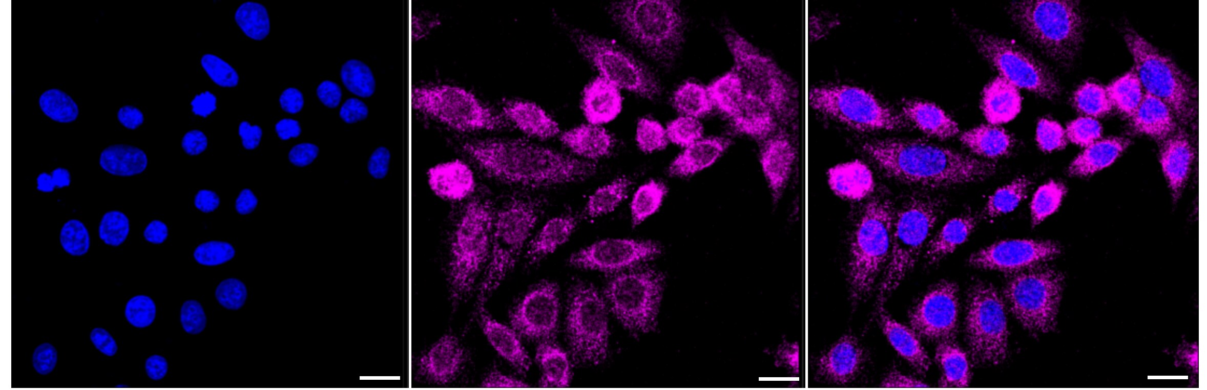 RIPK1/RIP1 Antibody (23GB2635)