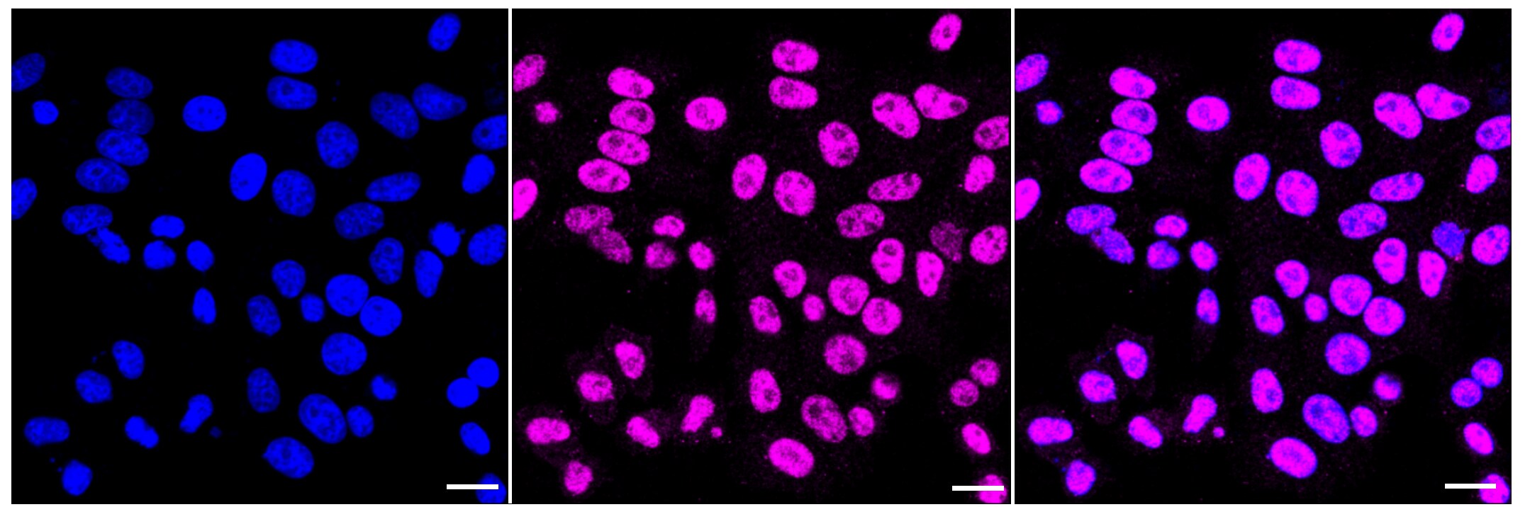 RNF20 Antibody (23GB2555)