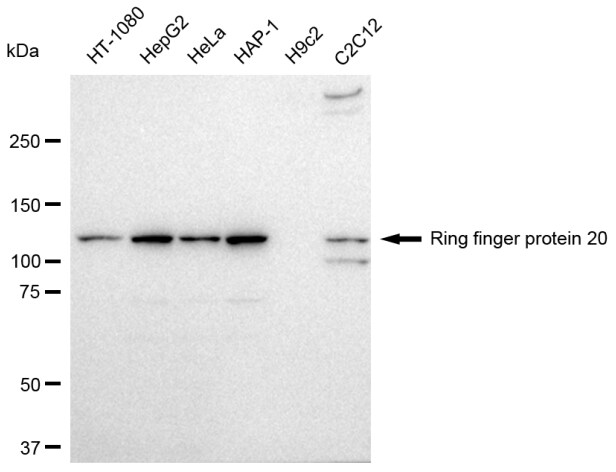 RNF20 Antibody (23GB2555)