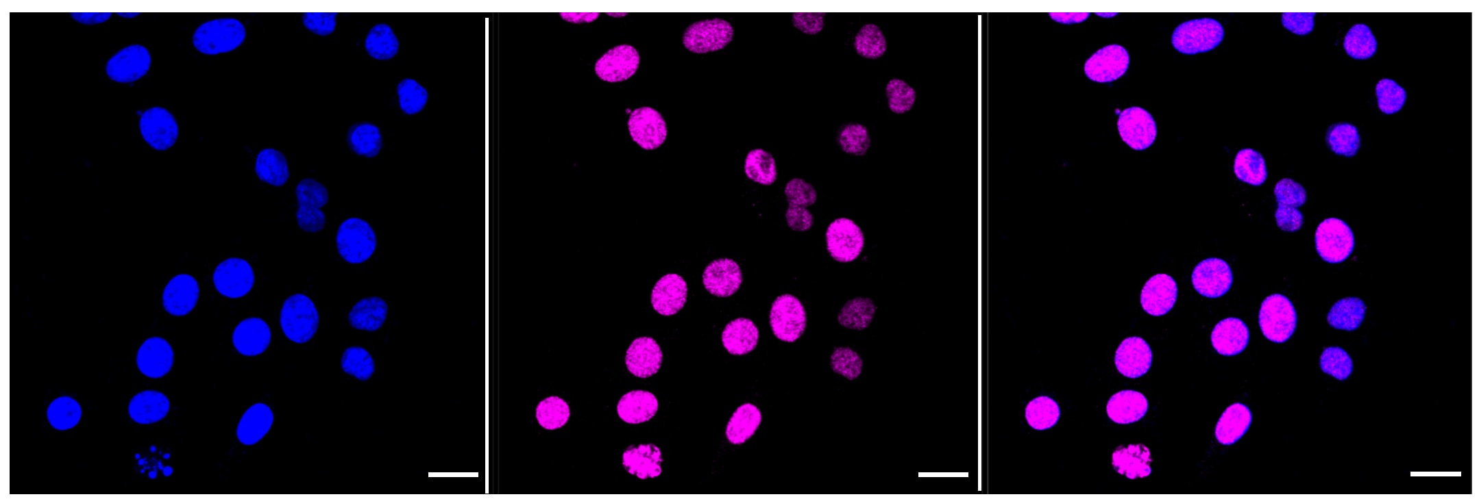 RPA2 [p Thr21] Antibody (23GB1950)