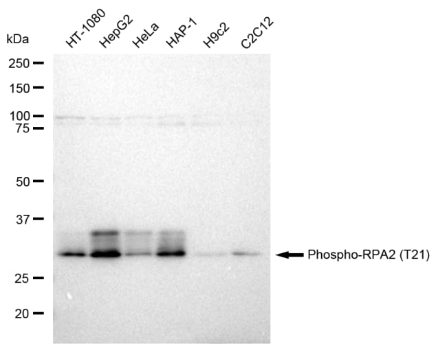 RPA2 [p Thr21] Antibody (23GB1950)