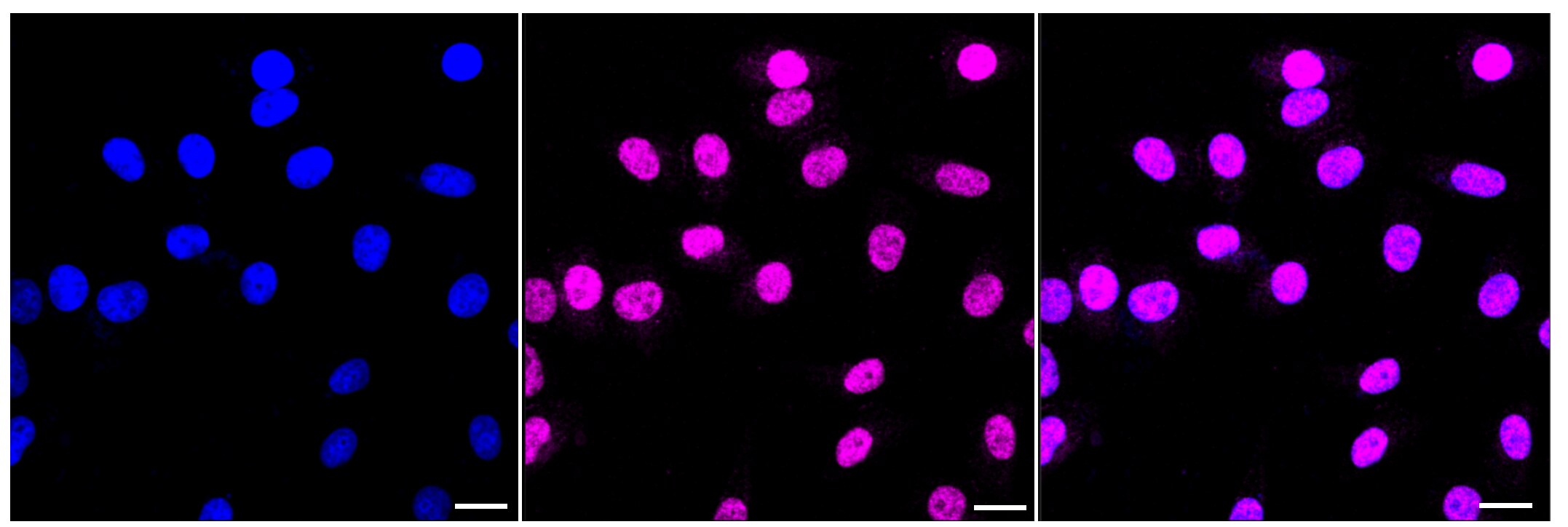 PRPF8 Antibody (23GB1995)
