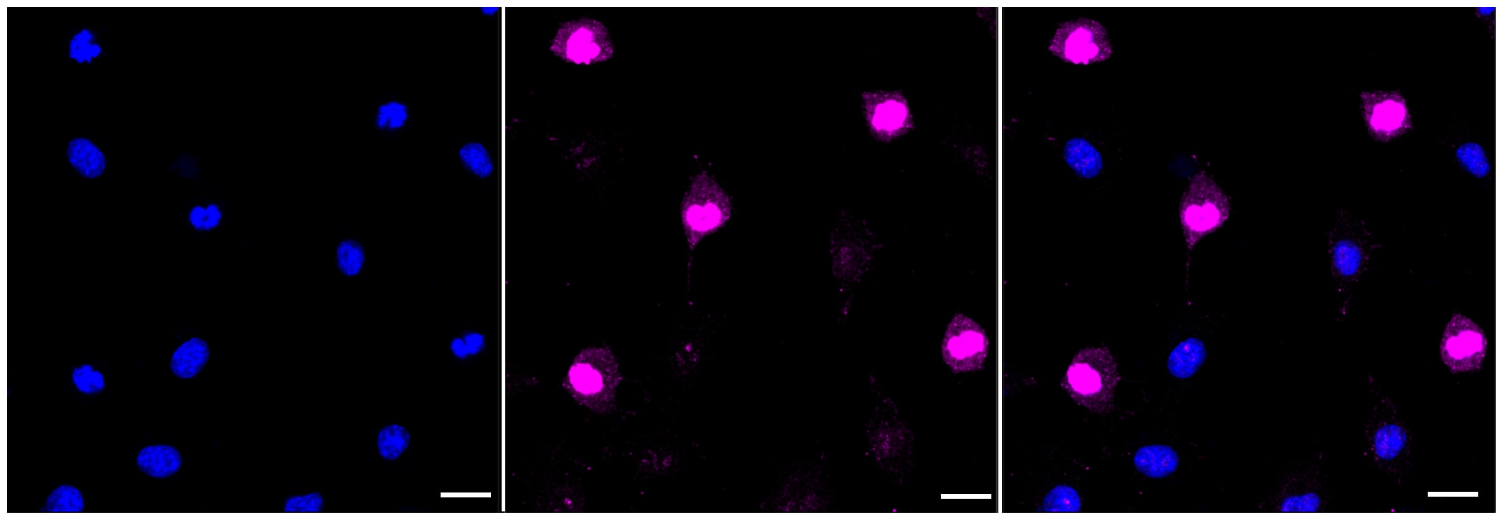 beta-Catenin [p Thr41] Antibody (23GB3875)