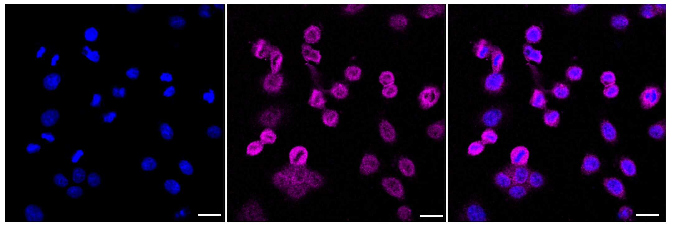 ROCK1 Antibody (23GB2065)
