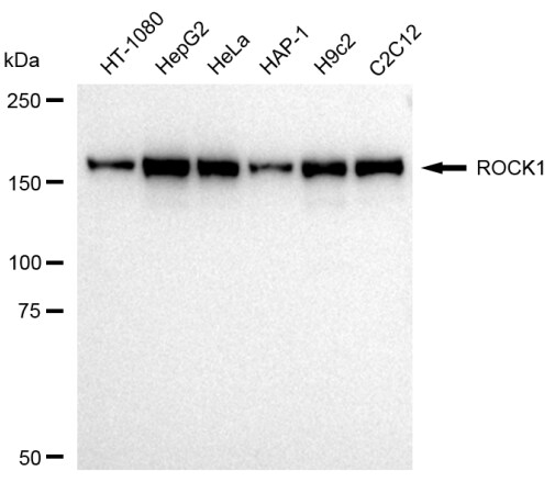 ROCK1 Antibody (23GB2065)