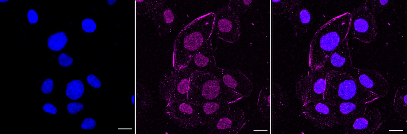 PSMB10/MECL1 Antibody (23GB2170)