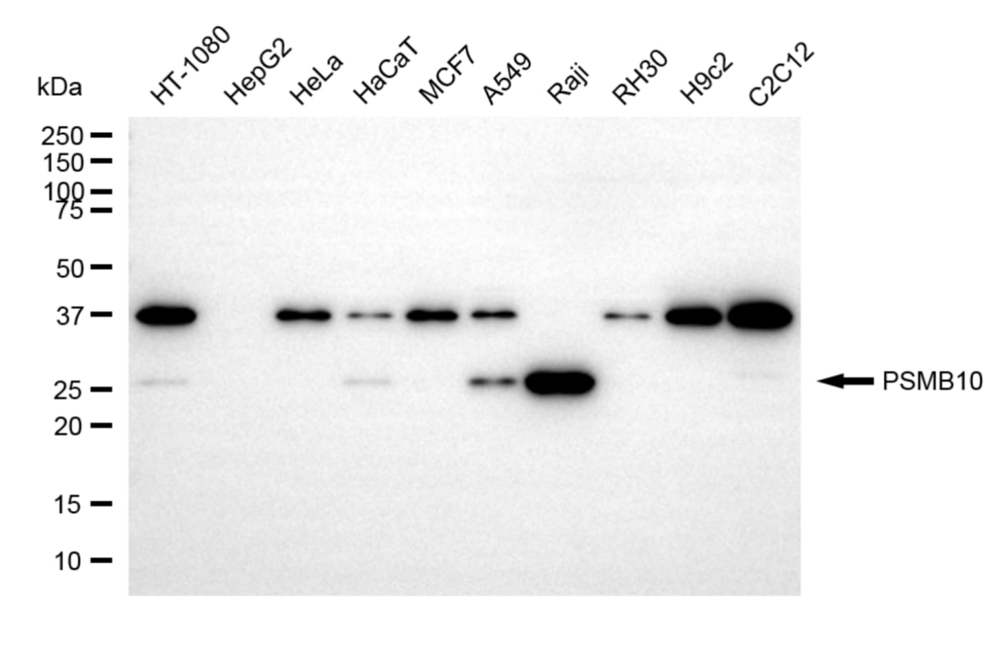 PSMB10/MECL1 Antibody (23GB2170)