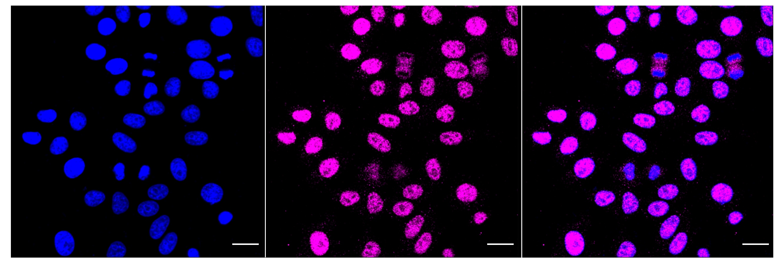 PLA2G2A Antibody (23GB2190)