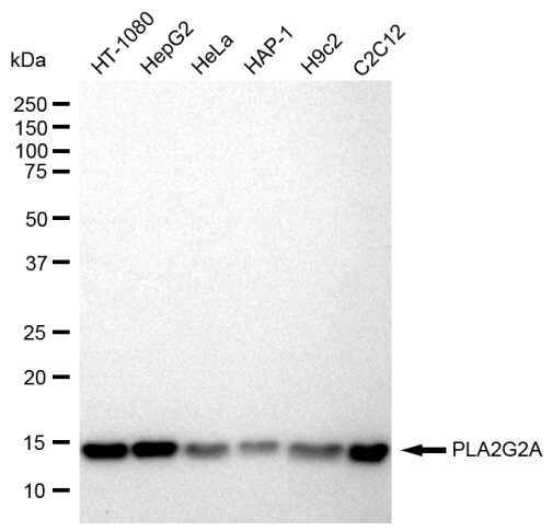 PLA2G2A Antibody (23GB2190)