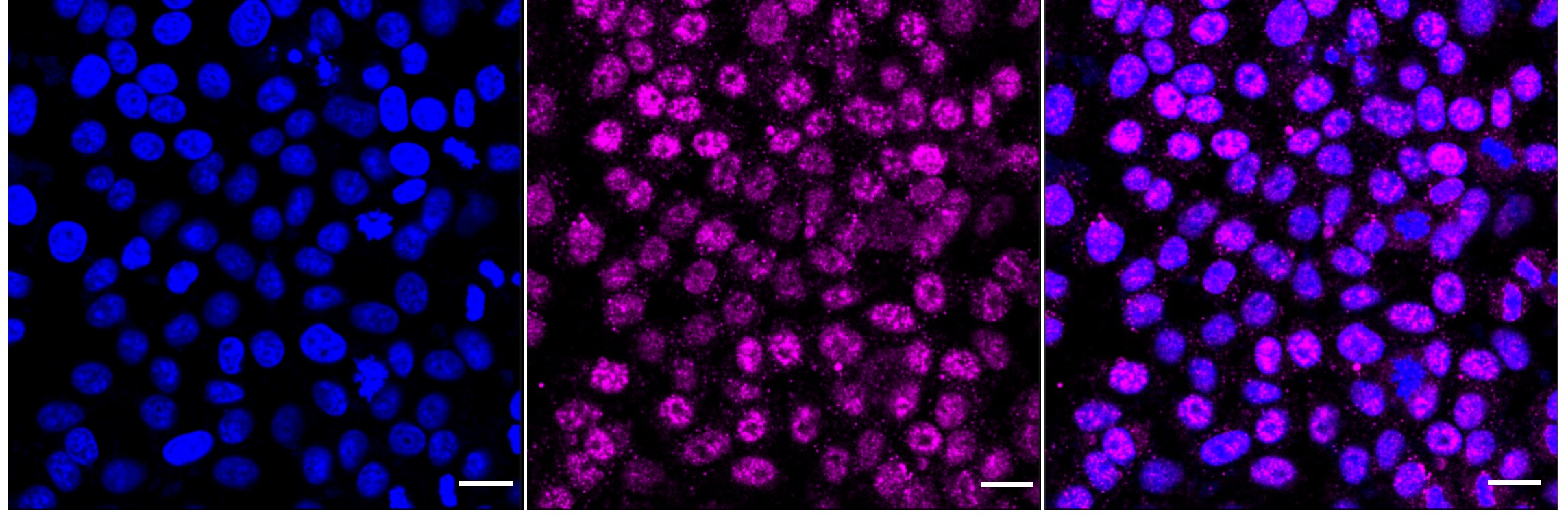 FosB/G0S3 Antibody (23GB2285)