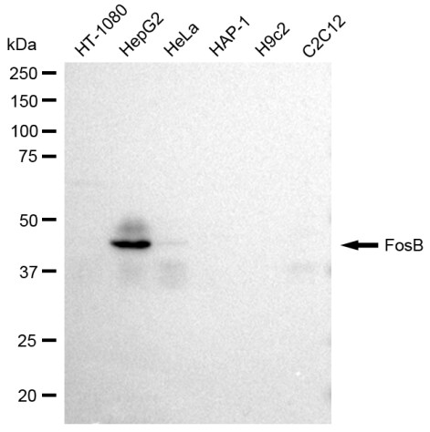 FosB/G0S3 Antibody (23GB2285)