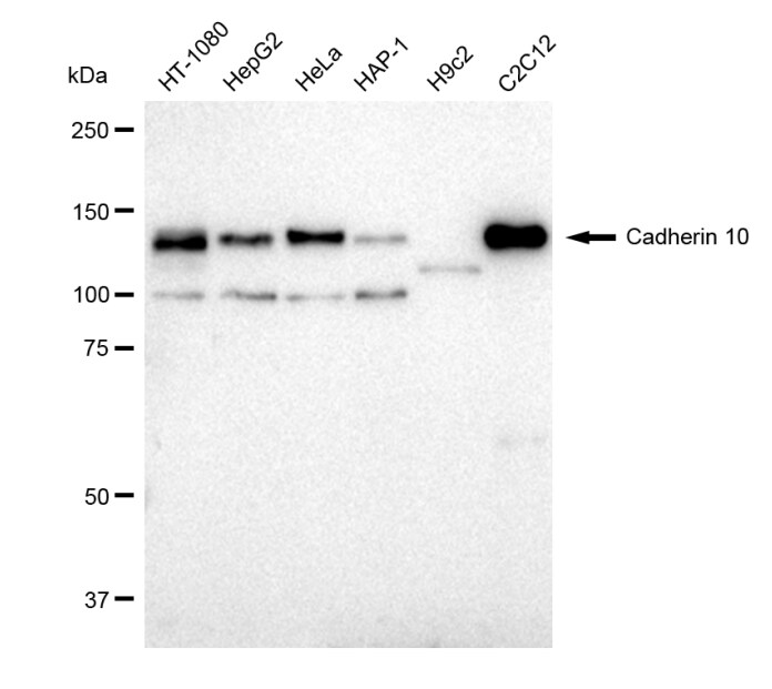 Cadherin-10 Antibody (23GB1600)