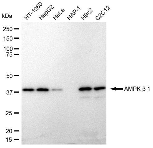 AMPK beta 1 Antibody (23GB2315)