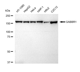 GABA-B R1 Antibody (23GB5495)