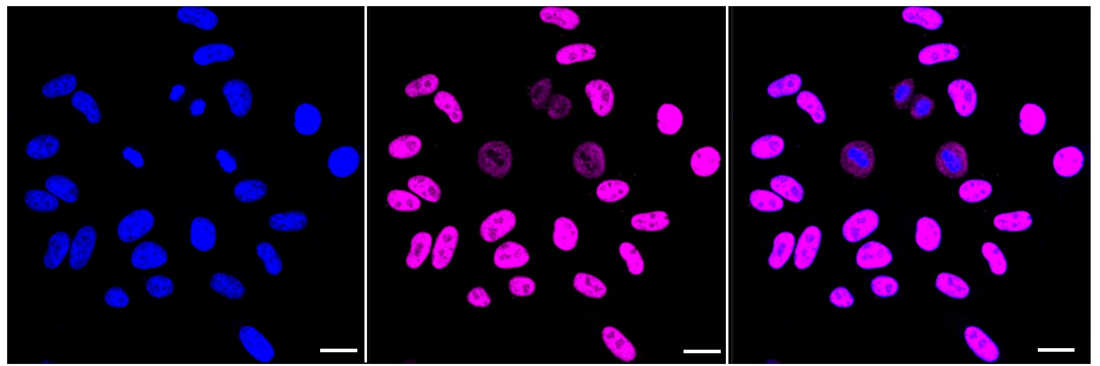 TCEA1 Antibody (23GB2330)