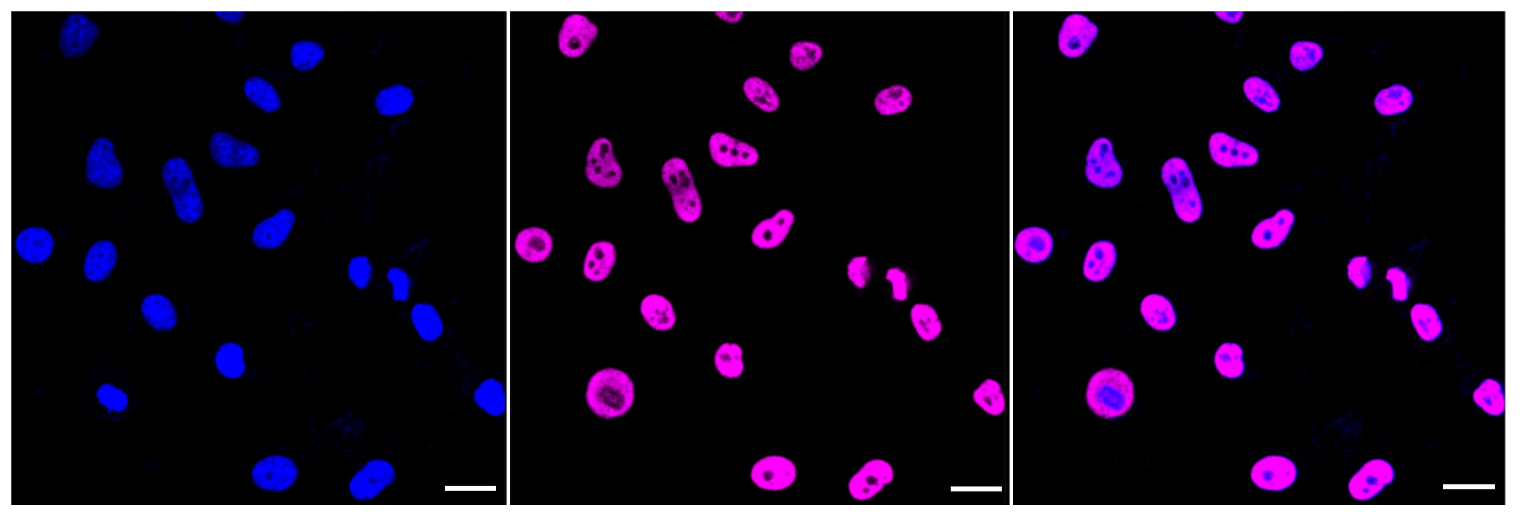 Histone Deacetylase 2/HDAC2 Antibody (23GB2900)