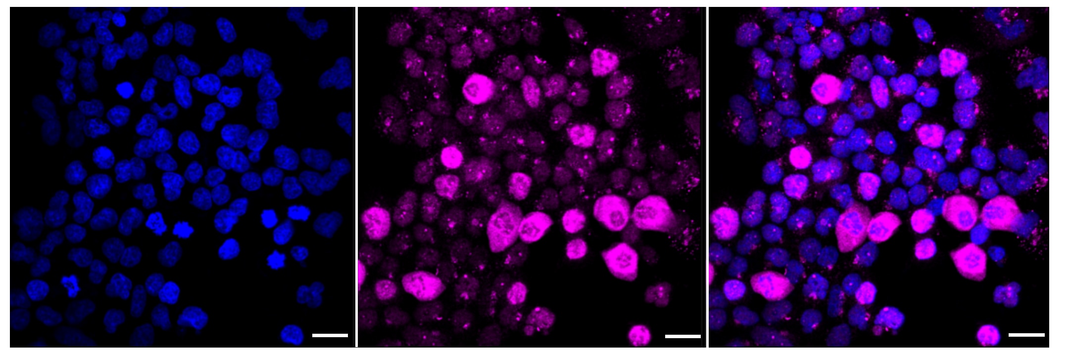 HSF1 [p Ser326] Antibody (23GB2775)