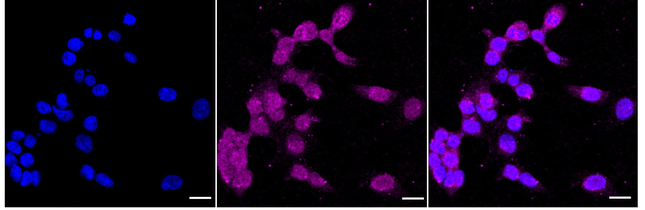 c-Myc [p Thr58] Antibody (24GB230)