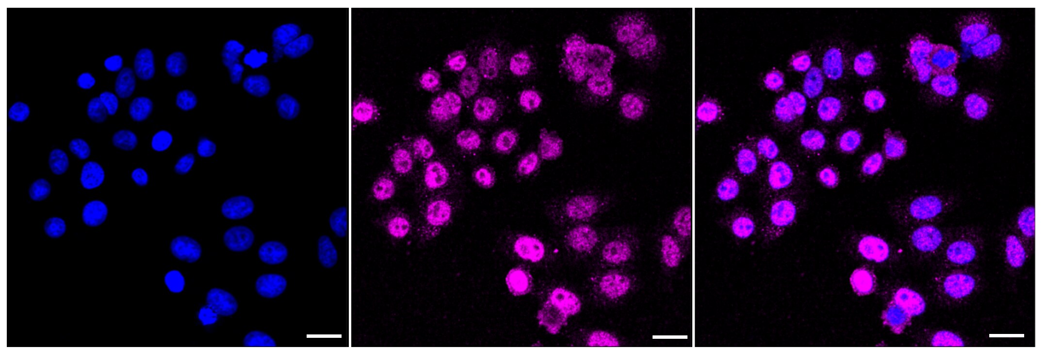 IKK epsilon/IKBKE Antibody (23GB2720)