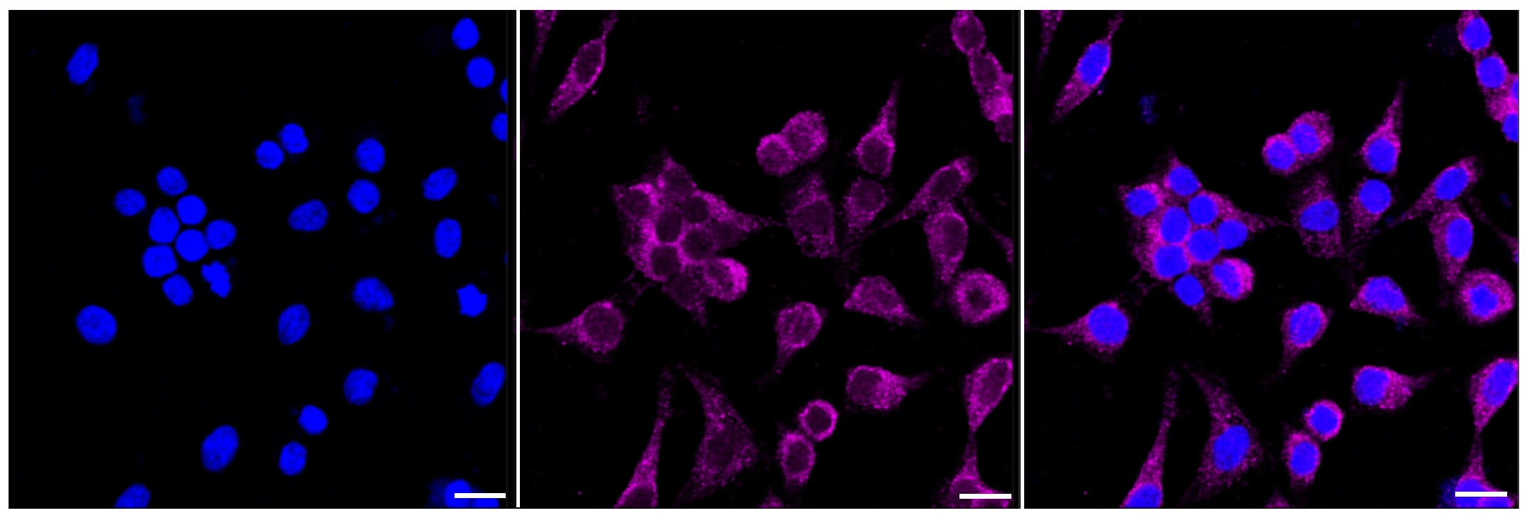 NFATC1/NFAT2 Antibody (24GB380)