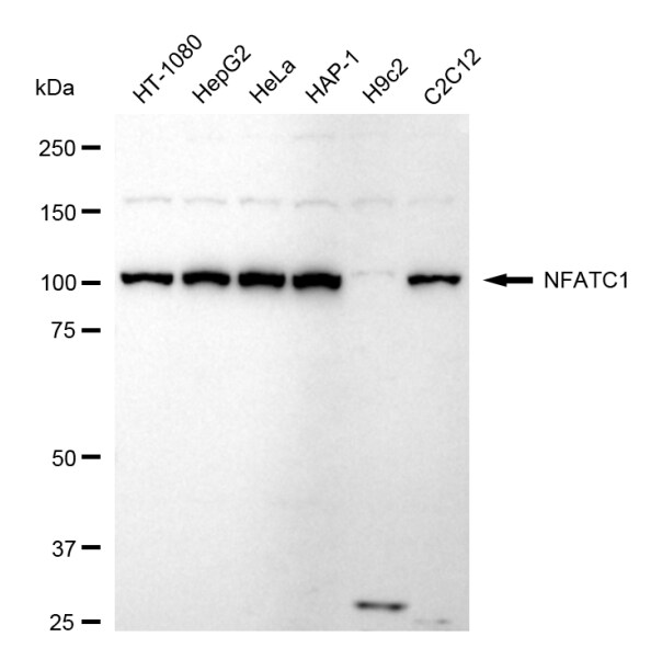 NFATC1/NFAT2 Antibody (24GB380)