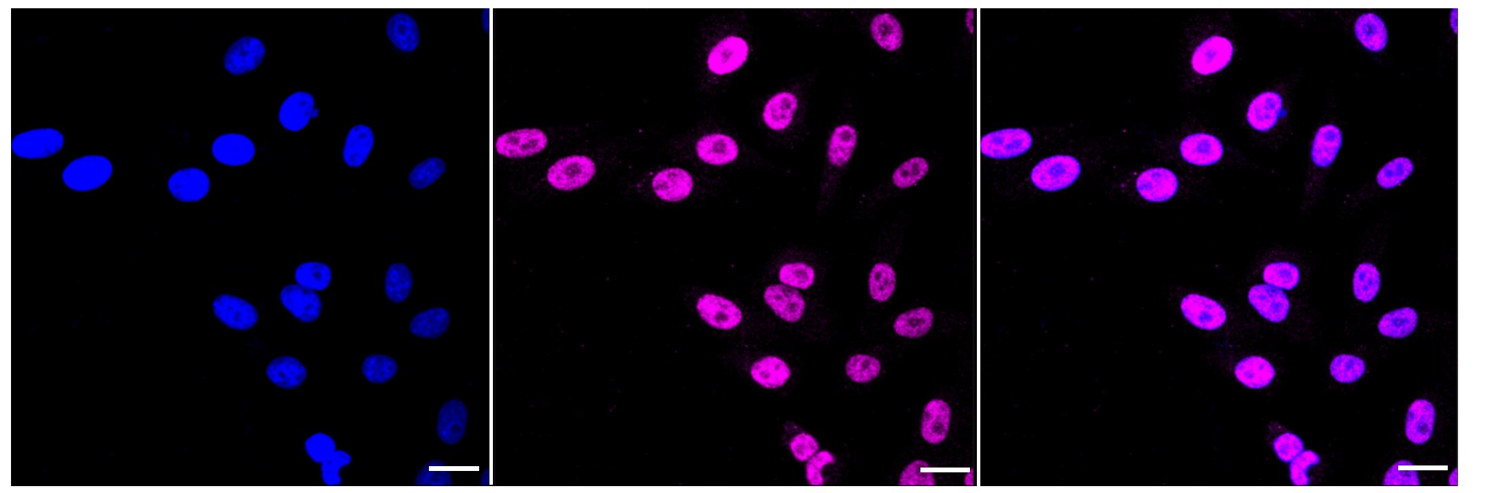 RNF20 Antibody (23GB2550)