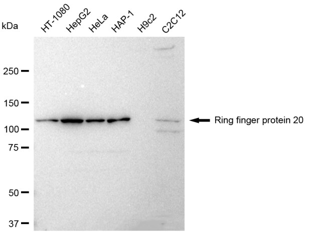 RNF20 Antibody (23GB2550)