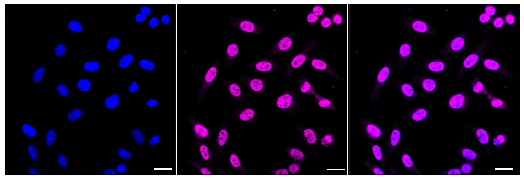 CPEB1 Antibody (23GB3495)