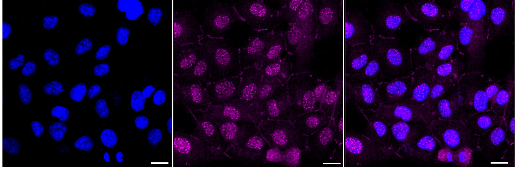 CHD1L Antibody (23GB3770)