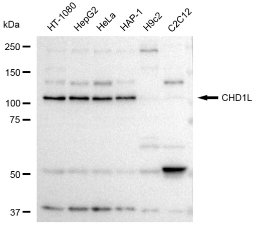 CHD1L Antibody (23GB3770)